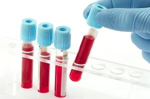 blood-fermentation-affects-dui-samples